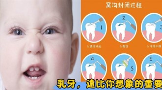 乳牙對孩子的成長發育真的很重要！媽媽別忽視